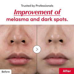 Eqqualberry Vitamin Illuminating Serum 30ml