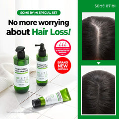 SOME BY MI Cica Peptide Anti Hair Loss Derma Scalp Tonic [150ml]